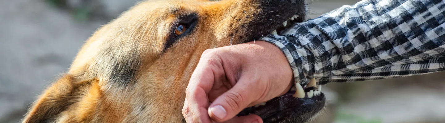 Dog Bites