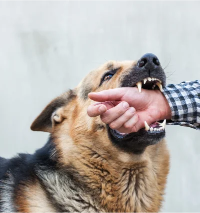 dog bites